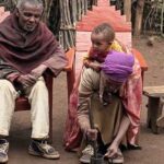 lepra en africa hospital de gambo